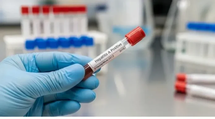 Gráfico con datos de Hepatitis A en Argentina y Entre Ríos