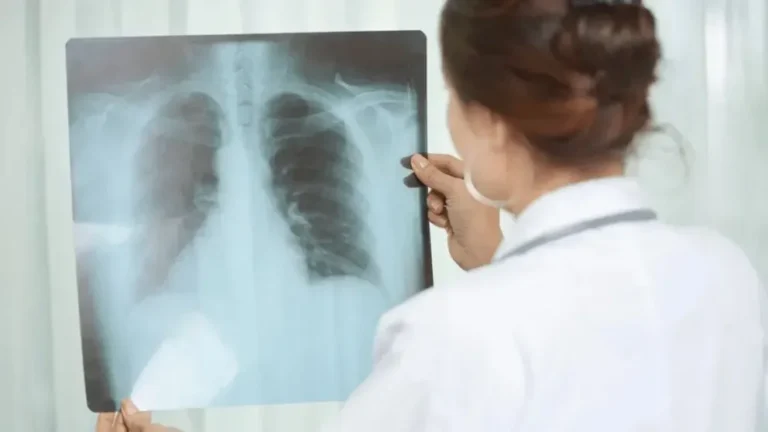 Gráfico de aumento de casos de tuberculosis en Entre Ríos en 2026