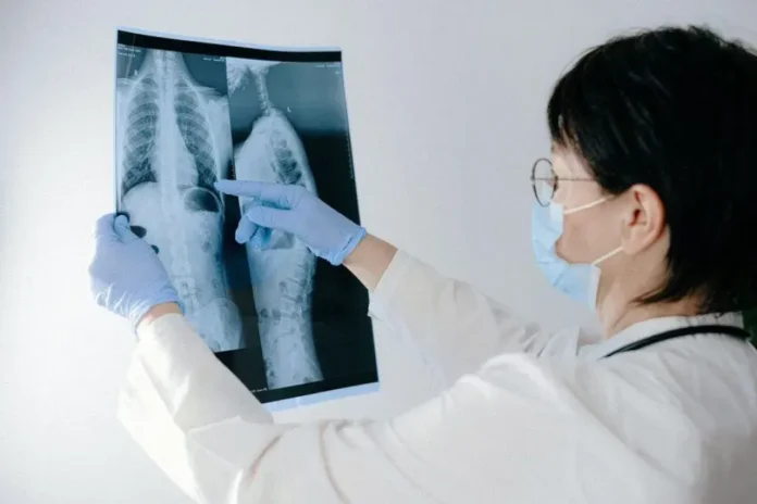 Cartel de la jornada informativa sobre tuberculosis en el CAPS Pueblo Nuevo de Gualeguaychú